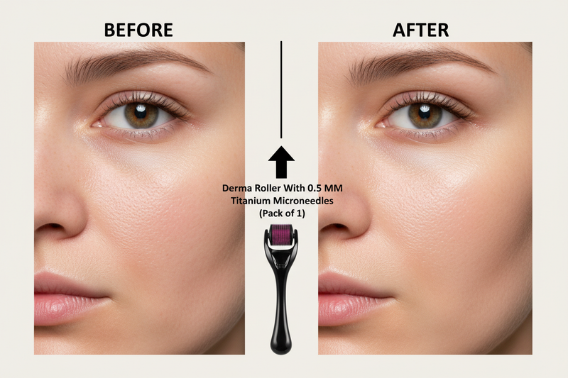 Derma Roller With 0.5 MM Titanium Microneedles  (Pack of 1 ) - beforeAfterSlider
